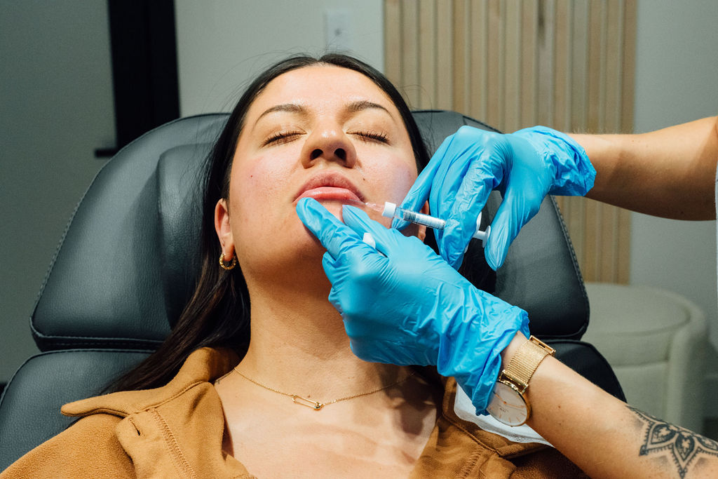 Front view of a woman undergoing the lip augmentation procedure done in a beauty salon by Breanna Injector | Ella Esthetics in Alexandria, VA