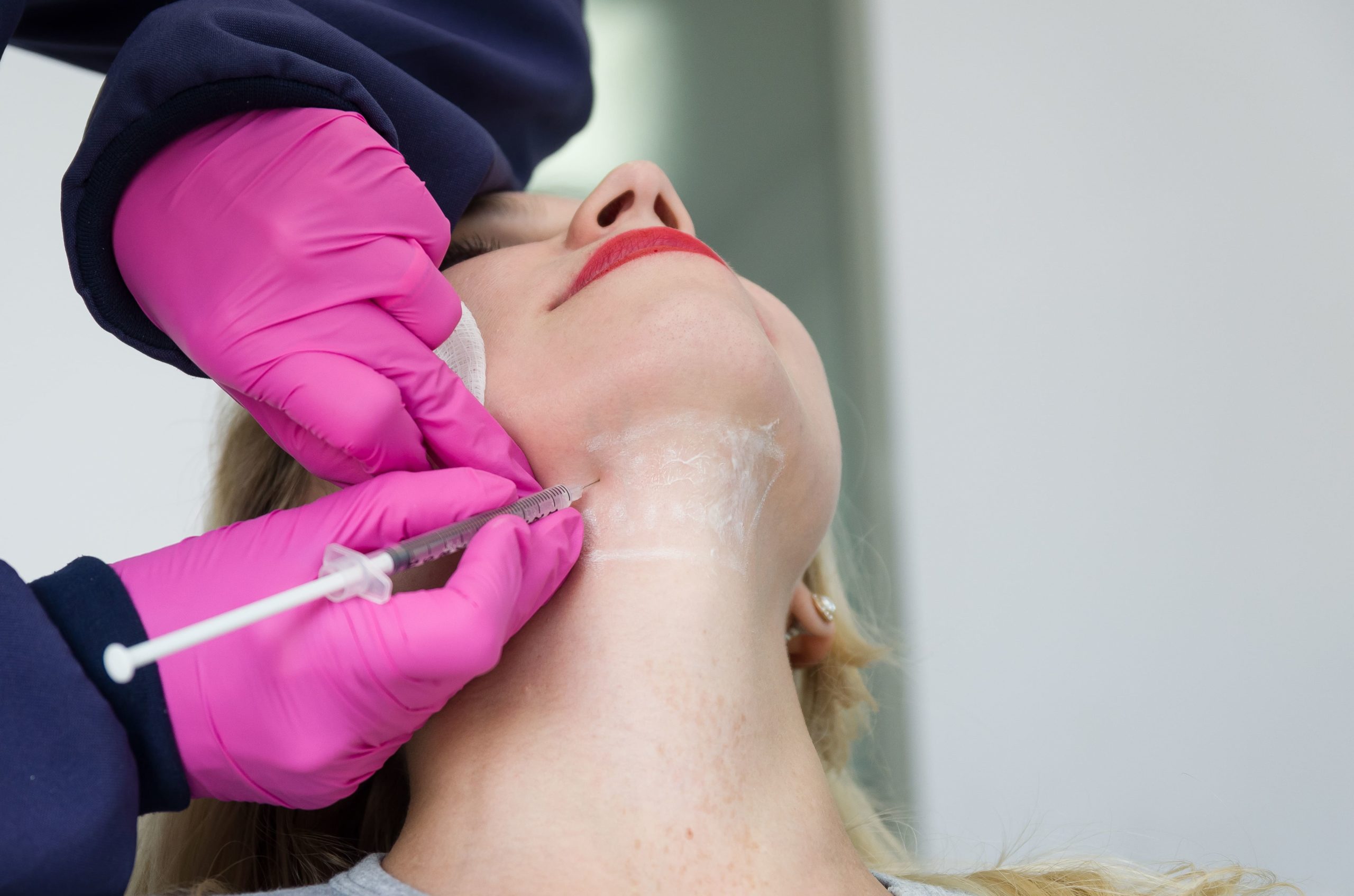The Secret to a Defined and Elegant Jawline Kybella's Remarkable Fat-Melting Treatment