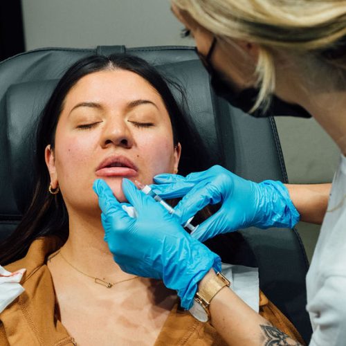 Front view of a woman undergoing the lip augmentation procedure done in a beauty salon by Breanna Injector | Ella Esthetics in Alexandria, VA
