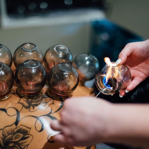 Cupping Therapy Placing jar to back of women and holding fire into jar by Nurse | Ella Esthetics in Alexandria, VA | Ella Esthetics in Alexandria, VA