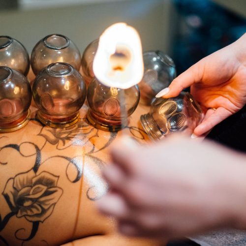Cupping Therapy Placing jar to back of women and holding fire in other hand by Nurse | Ella Esthetics in Alexandria, VA | Ella Esthetics in Alexandria, VA
